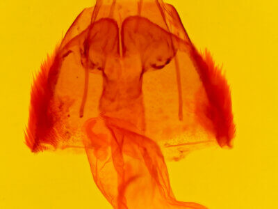 genitalia view of adult Actinotoia radiosa