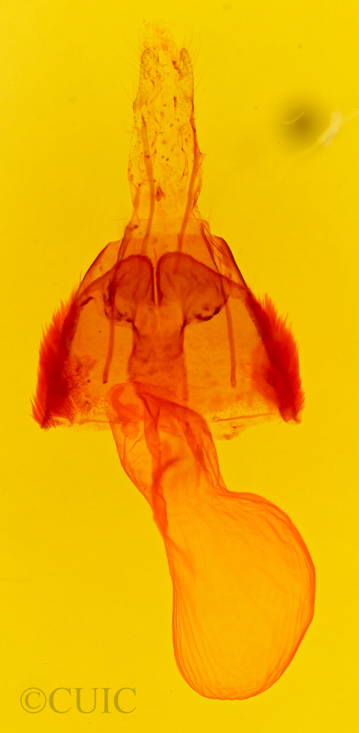 genitalia view of adult Actinotoia radiosa