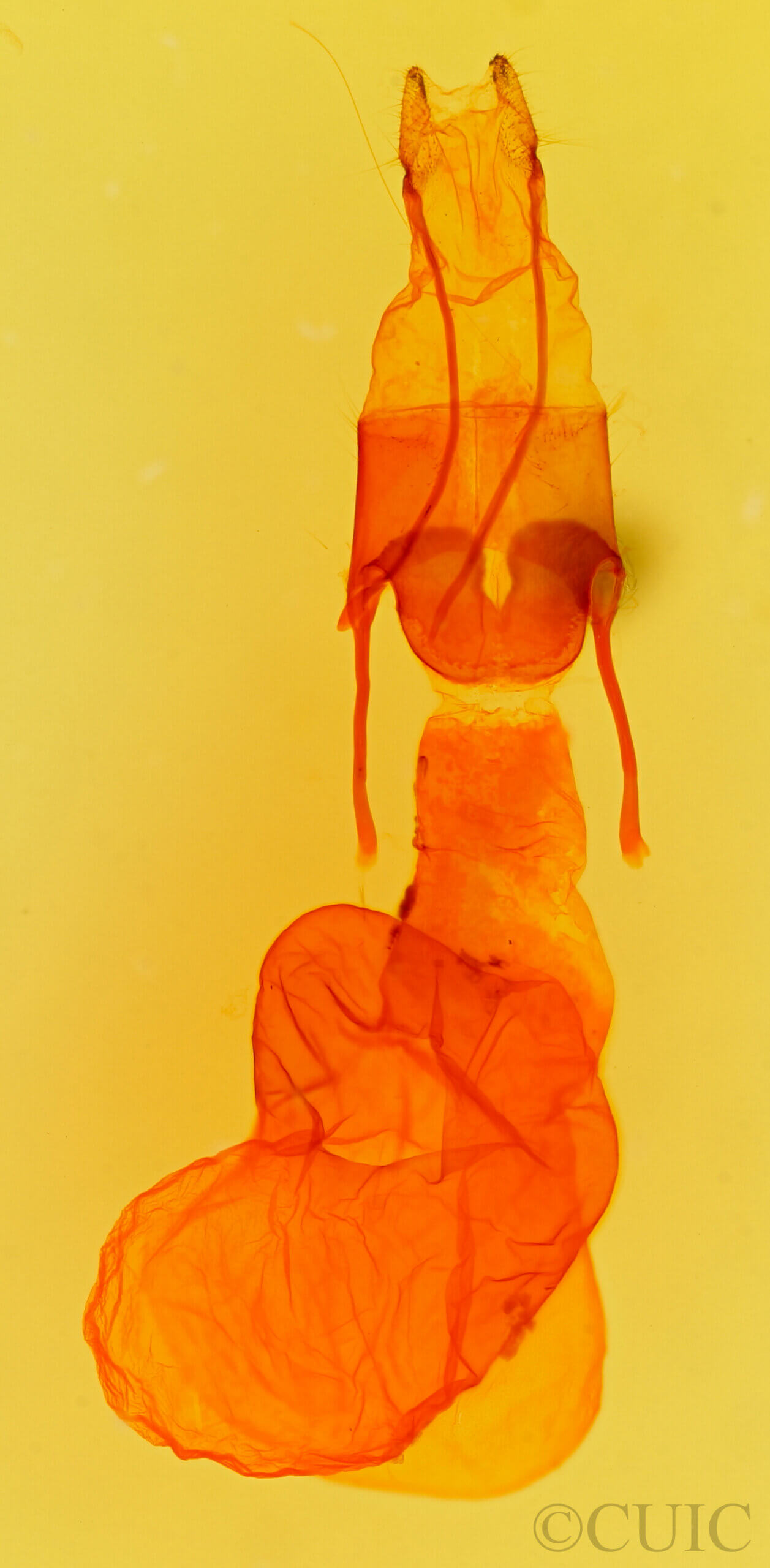 genitalia view of adult Protoperigea sp.