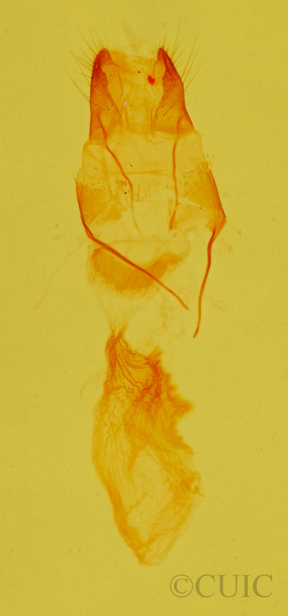 genitalia view of adult Exyra fax