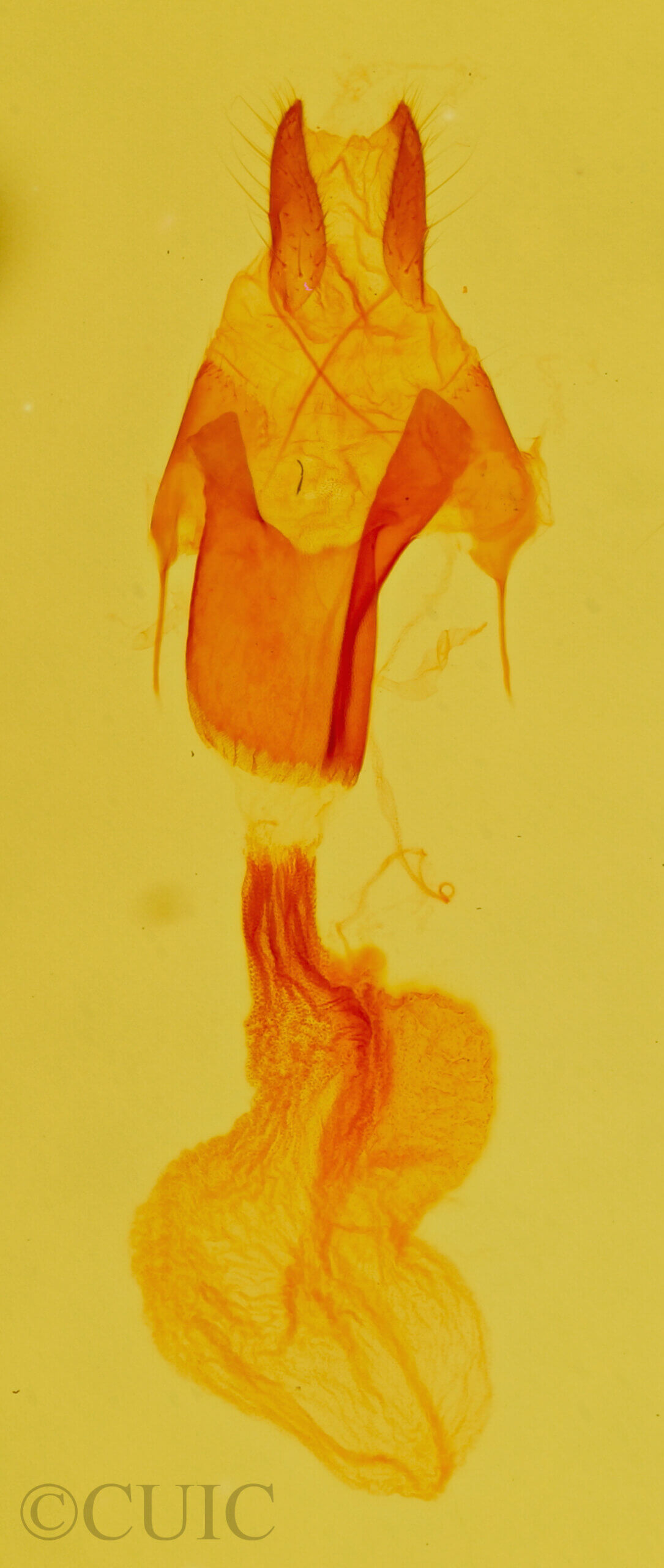 genitalia view of adult Exyra ridingsii