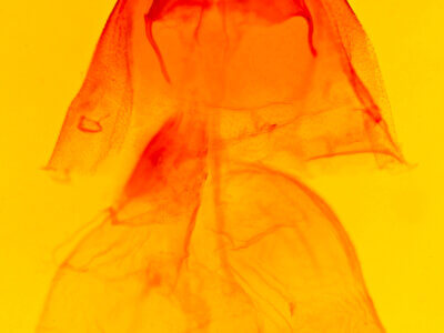 genitalia view of adult Acronicta parallela