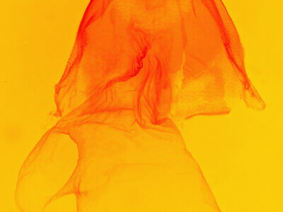 genitalia view of adult Acronicta strigulata