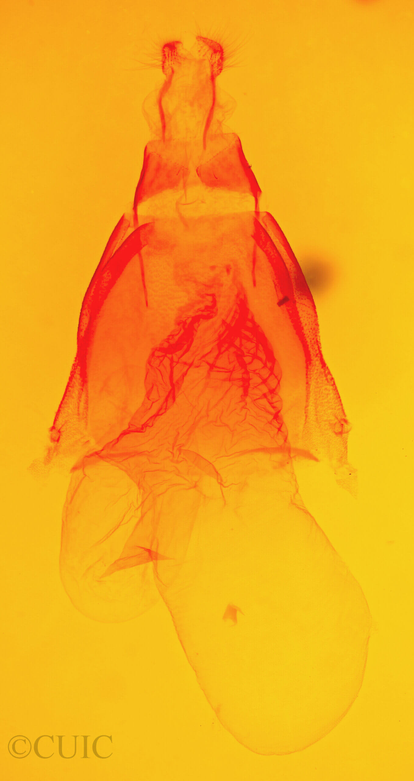 genitalia view of adult Acronicta thoracica