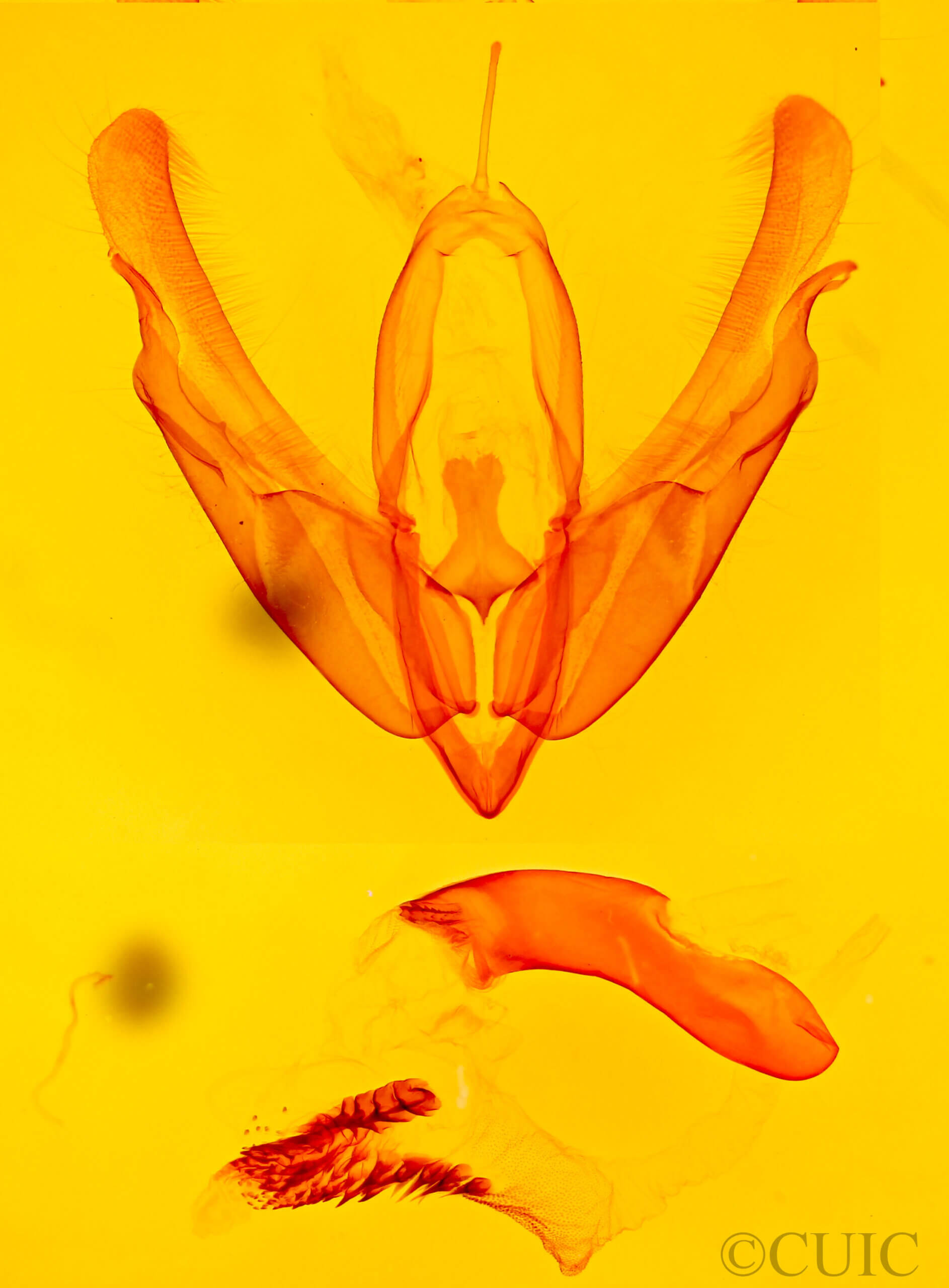 genitalia view of adult Acronicta laetifica