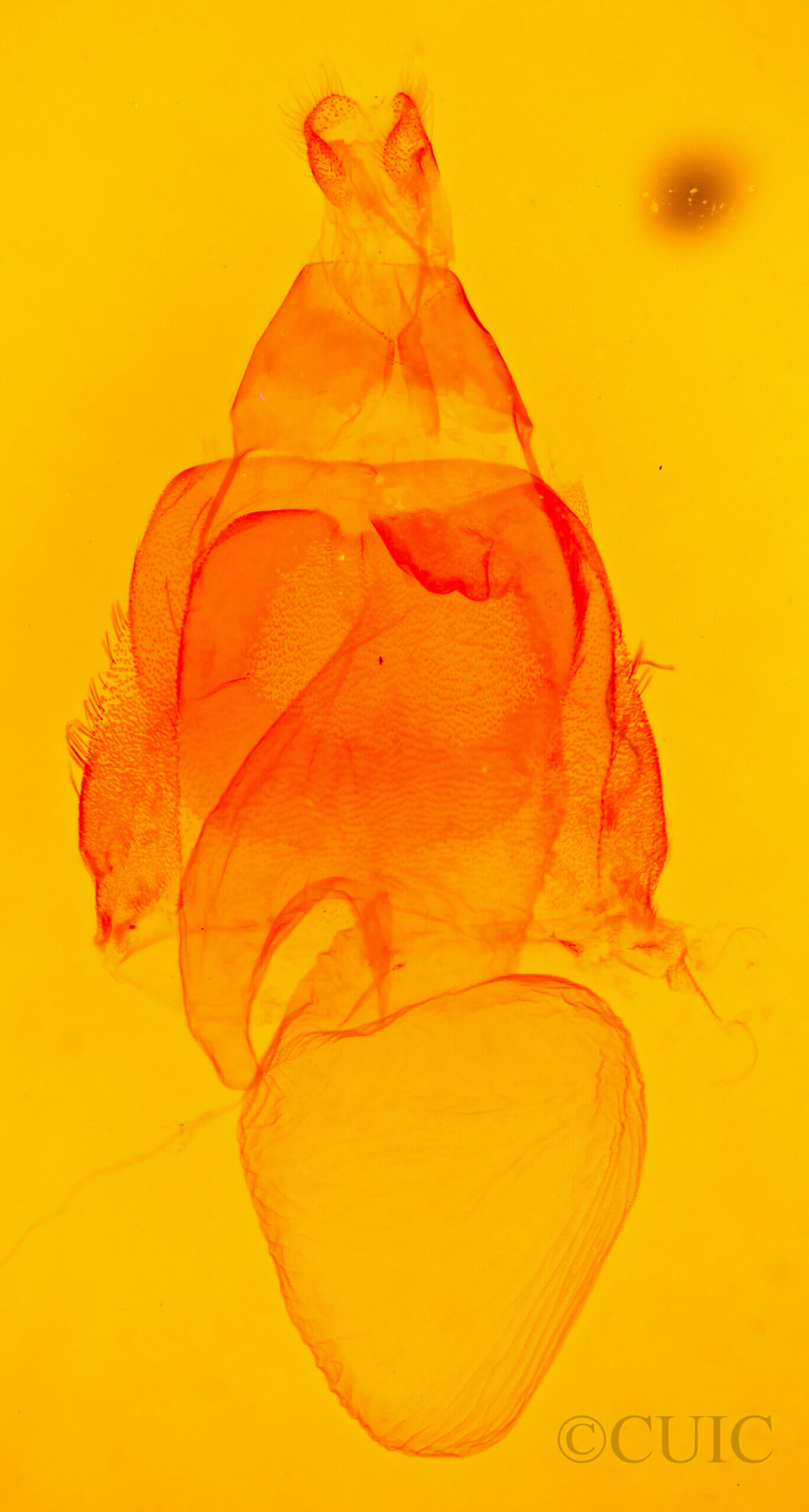 genitalia view of adult Acronicta laetifica