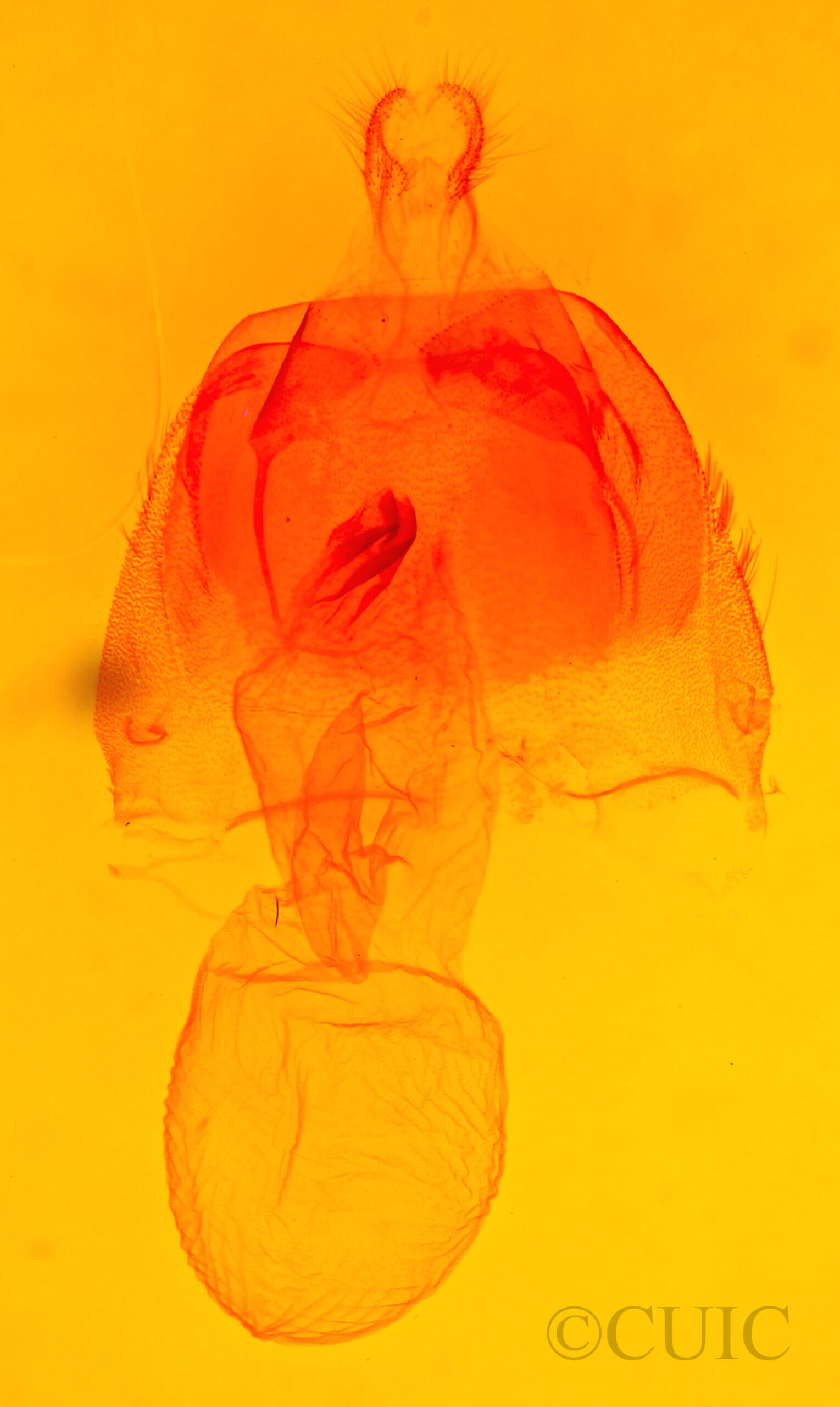 genitalia view of adult Acronicta hasta