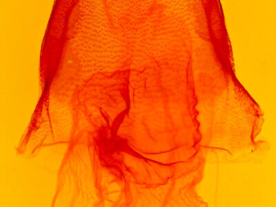 genitalia view of adult Acronicta clarescens