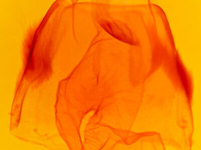 genitalia view of adult Acronicta superans