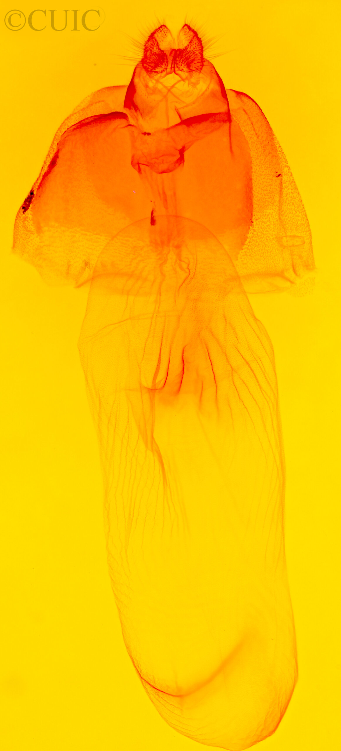 genitalia view of adult Acronicta brumosa