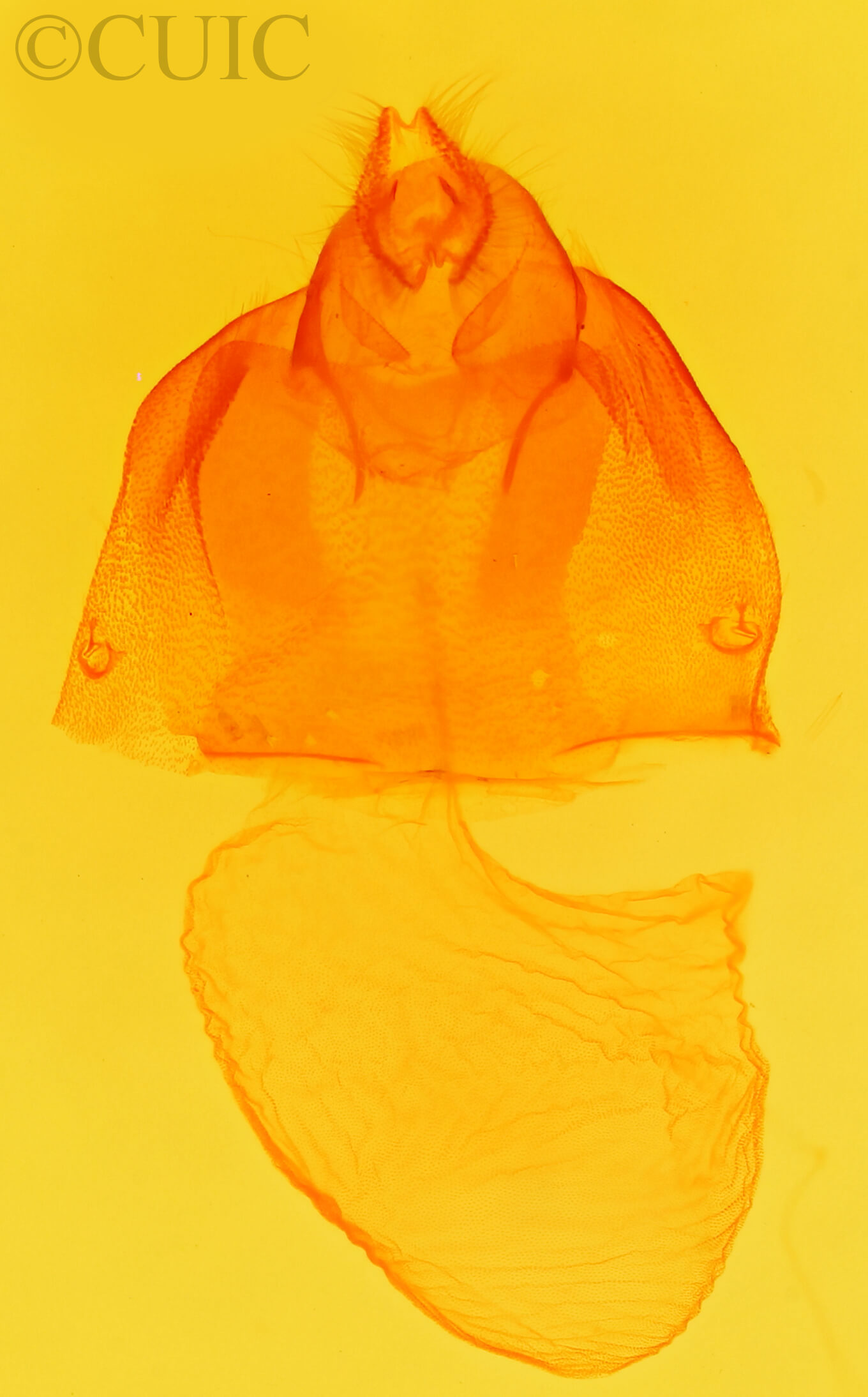 genitalia view of adult Acronicta albarufa