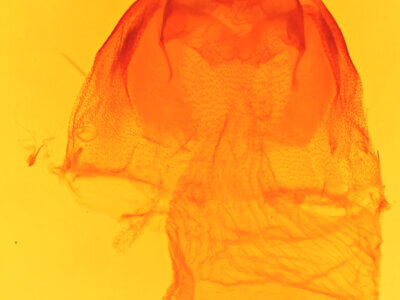 genitalia view of adult Acronicta tristis