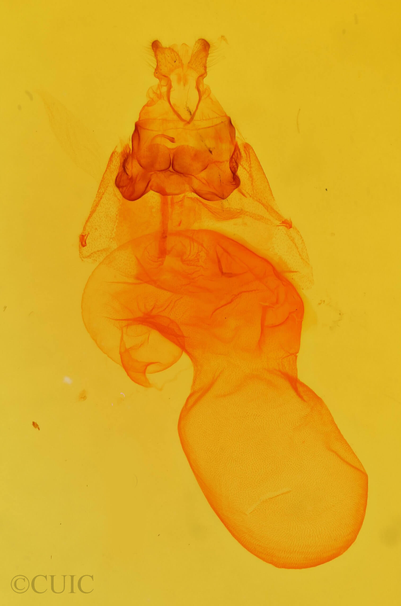 genitalia view of adult Acronicta retardata