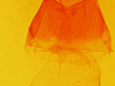 genitalia view of adult Acronicta impleta