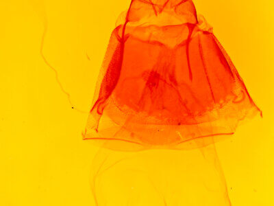 genitalia view of adult Acronicta longa