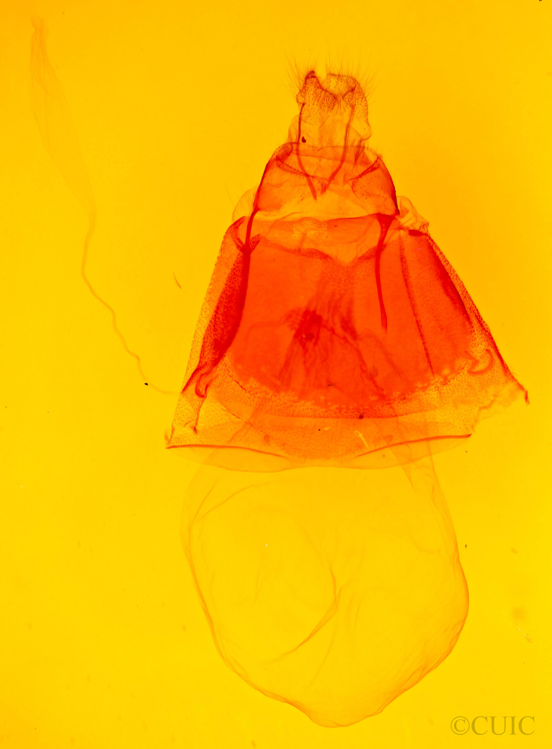 genitalia view of adult Acronicta longa