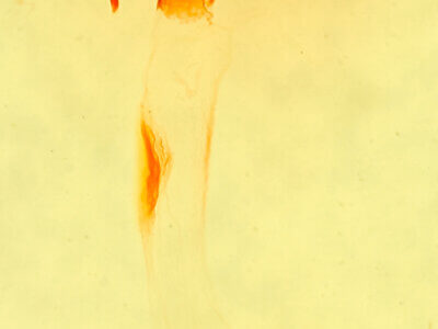 genitalia view of adult Cosmia sp.