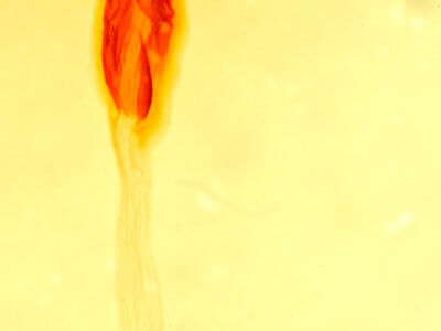 genitalia view of adult Mammifrontia rileyi