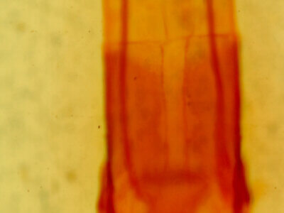 genitalia view of adult Enargia sp.