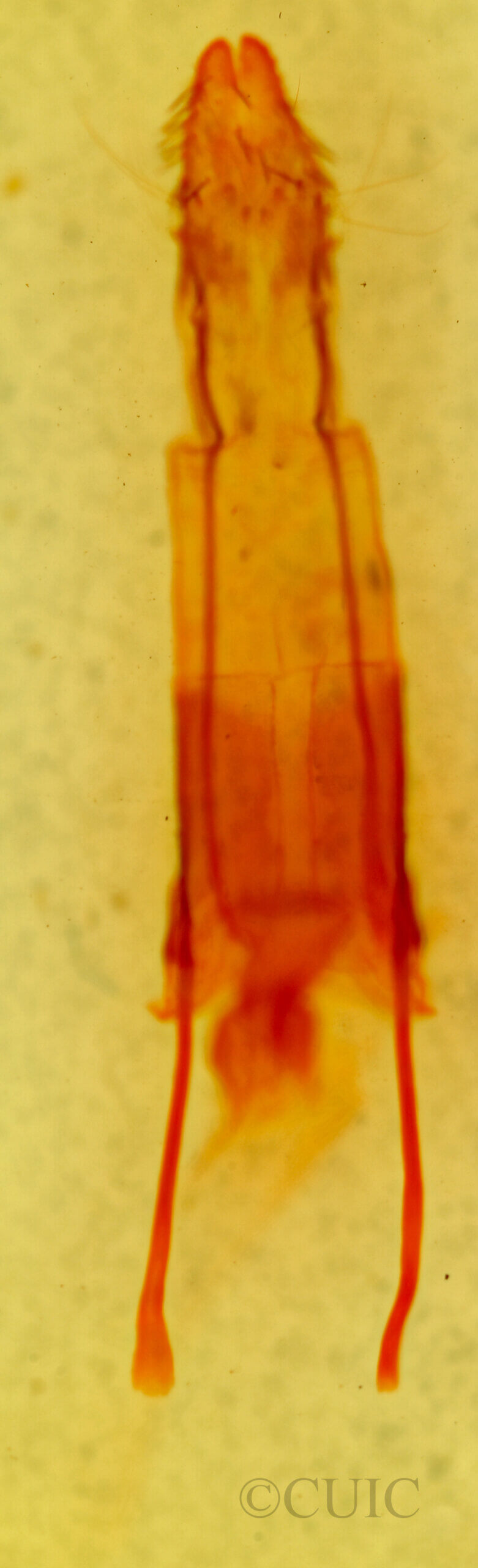 genitalia view of adult Enargia sp.