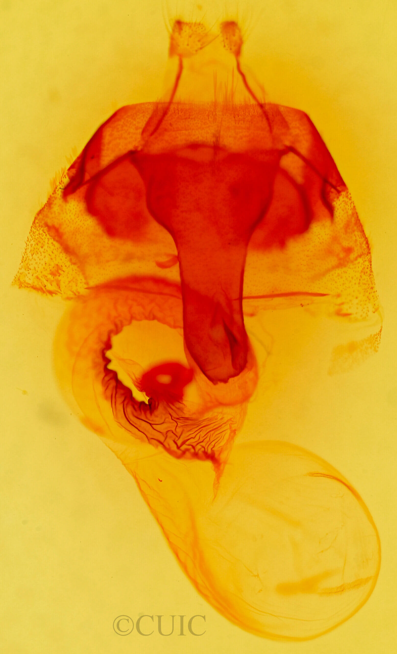 genitalia view of adult Orthosia erythrolita
