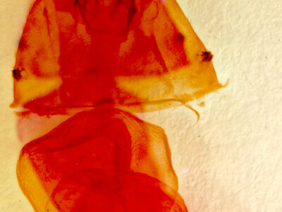 genitalia view of adult Loxagrotis ? herculeana