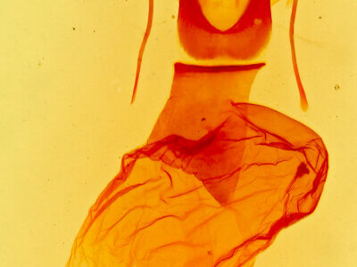 genitalia view of adult Caradrina meralis