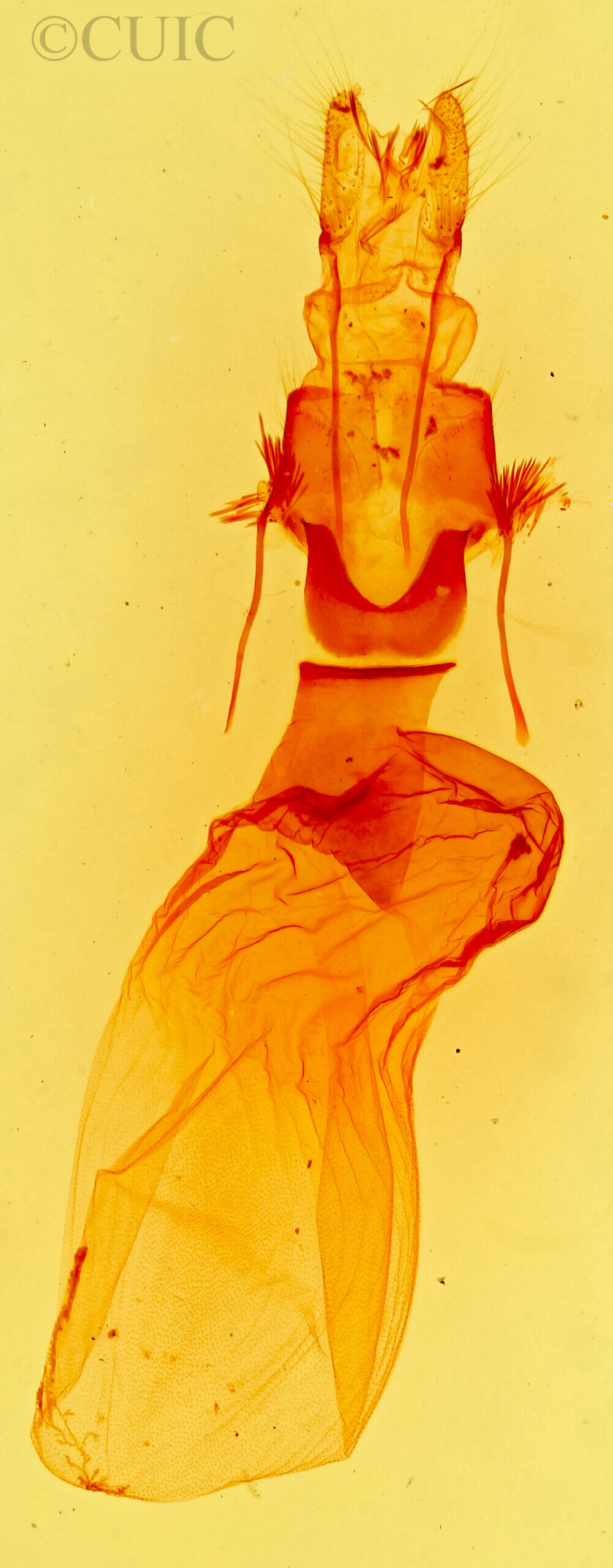 genitalia view of adult Caradrina meralis