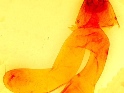 genitalia view of adult Dichagyris larga