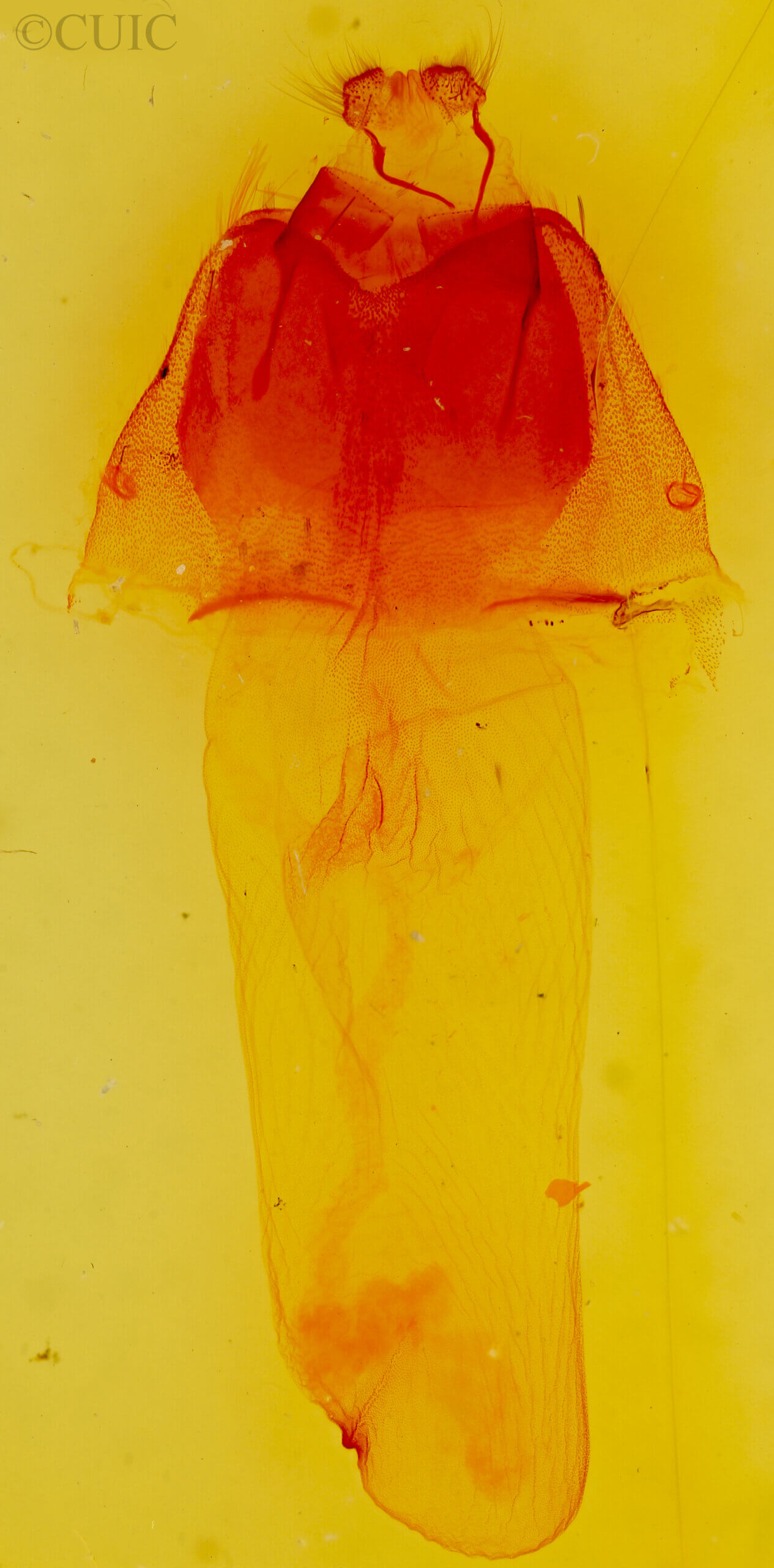 genitalia view of adult Acronicta brumosa group large