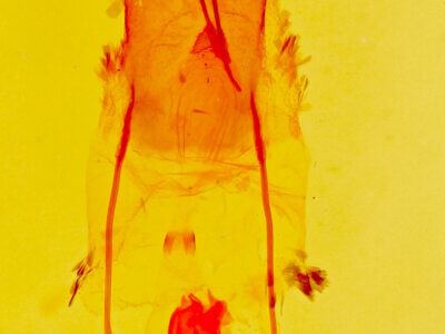 genitalia view of adult Stenoporpia mediatra ?