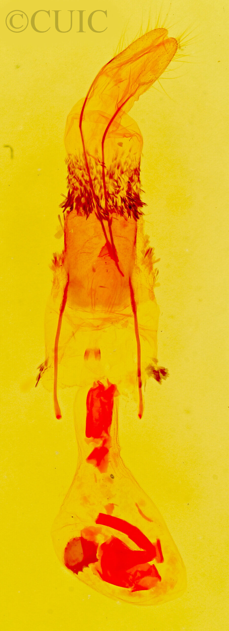 genitalia view of adult Stenoporpia mediatra ?