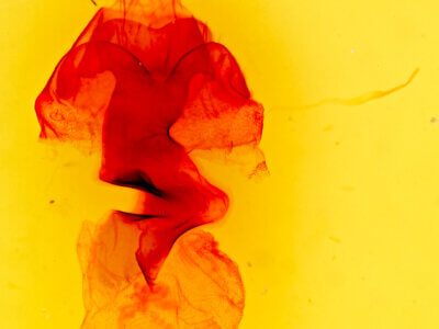 genitalia view of adult Hyssia degenerans