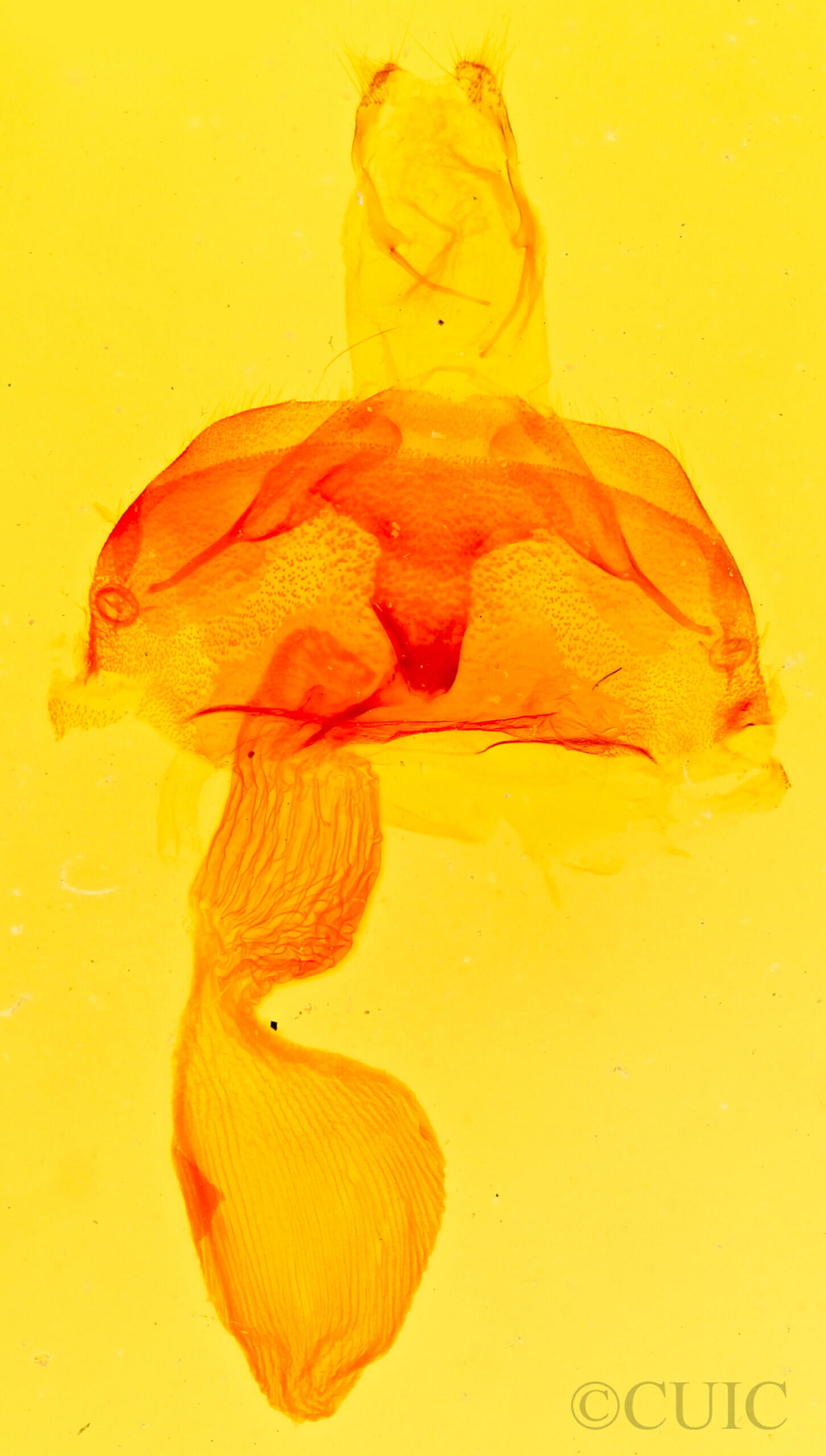 genitalia view of adult Abagrotis sp.