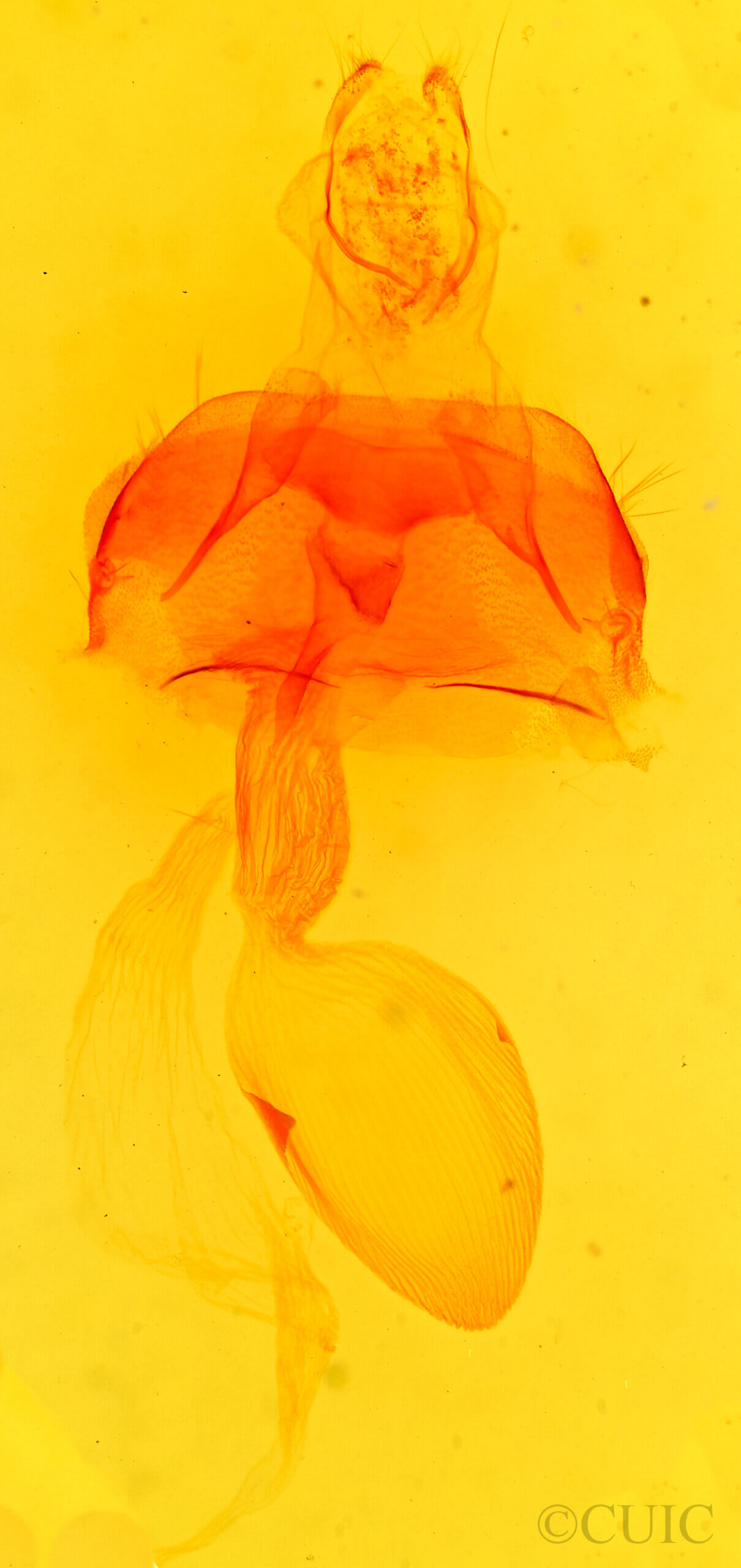 genitalia view of adult Abagrotis sp.