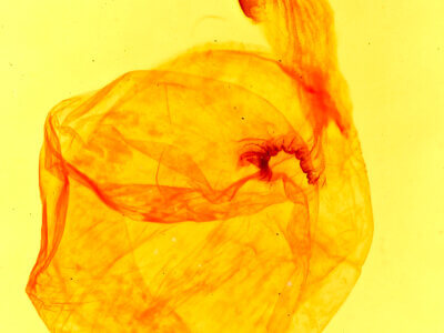 genitalia view of adult Trichorthosia sp.