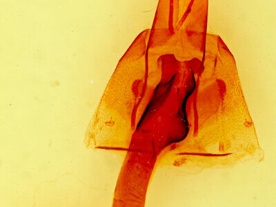 genitalia view of adult Lacinipolia sp.