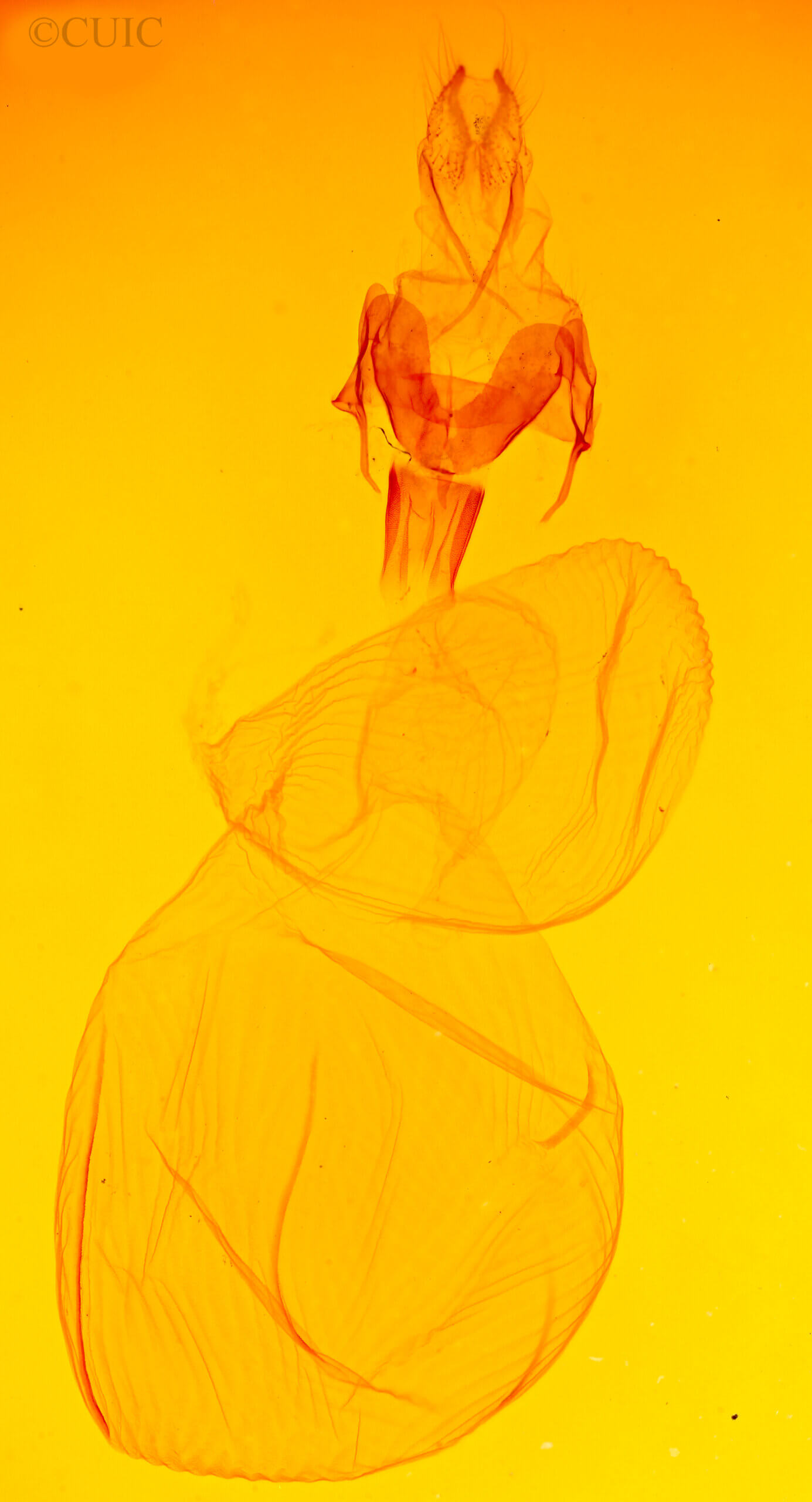 genitalia view of adult Xestia c-nigrum