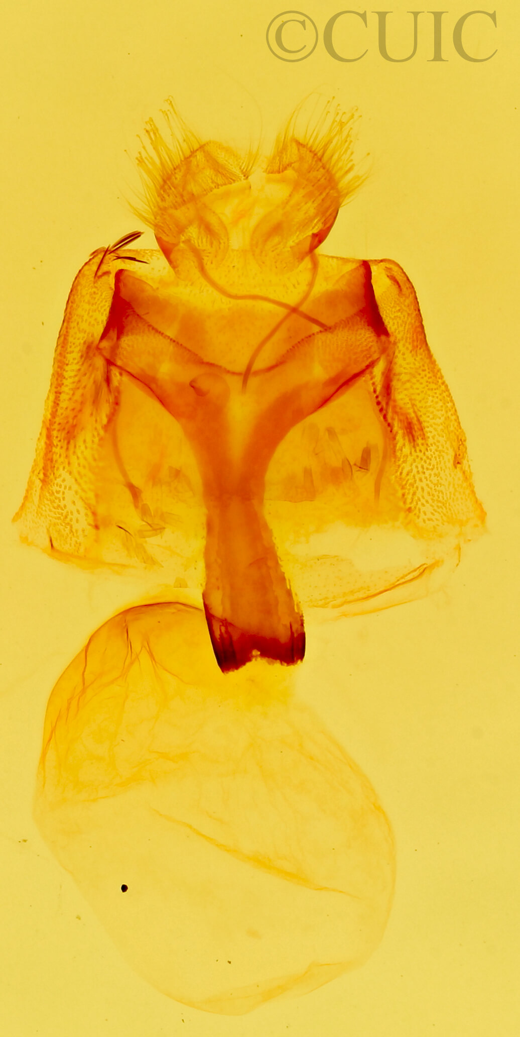 genitalia view of adult Anycteola fotelloides