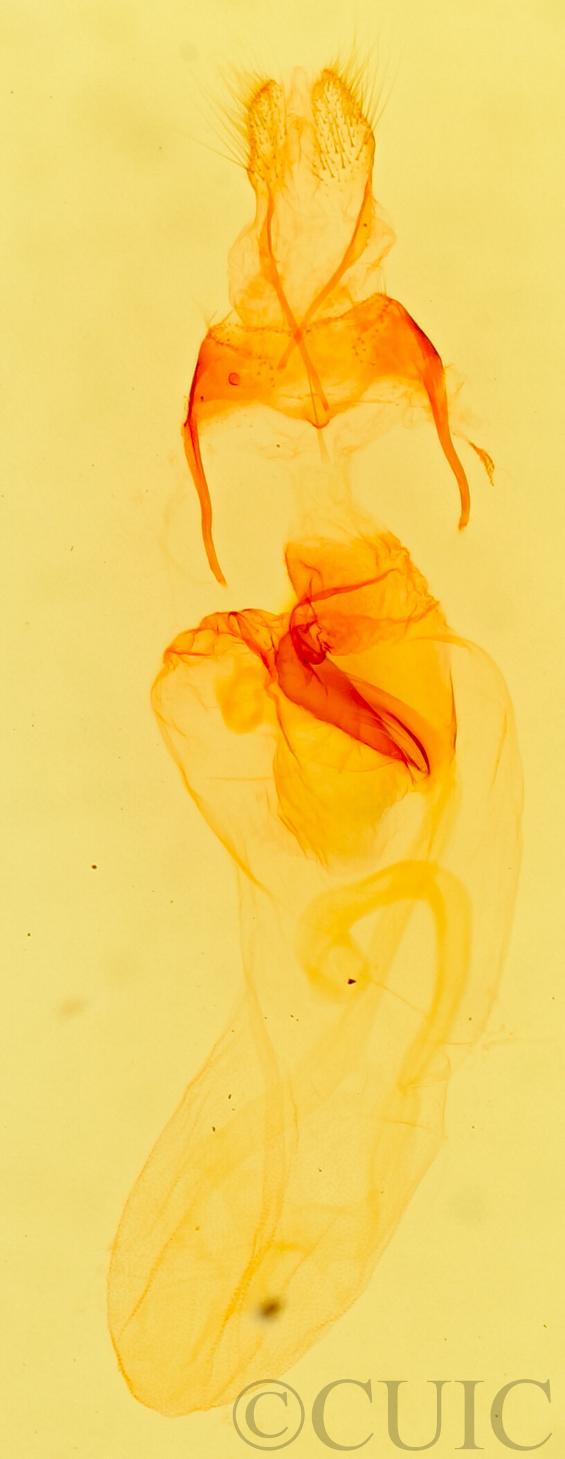 genitalia view of adult Prothrinax luteomedia