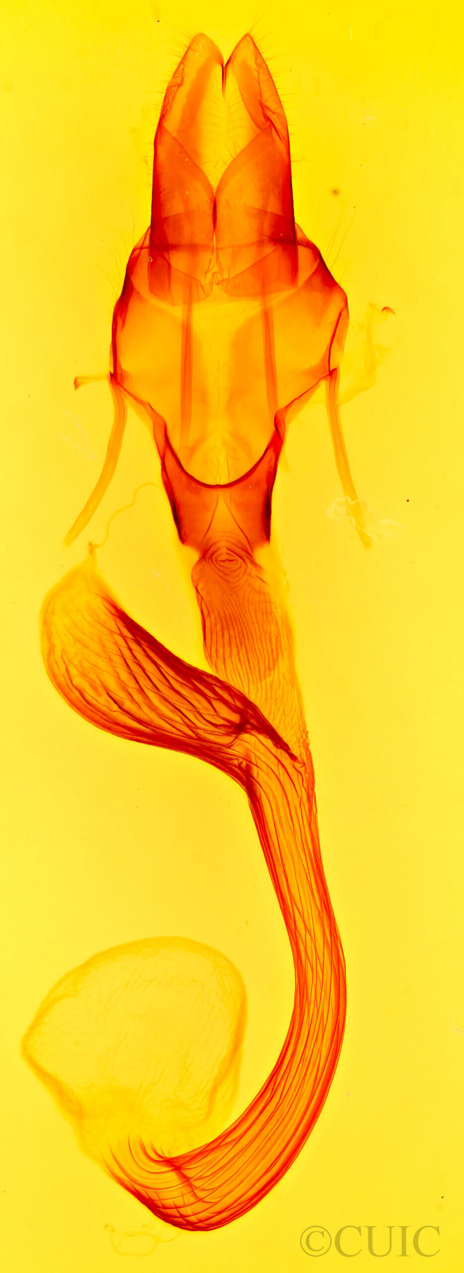 genitalia view of adult Leucania pseudargyria