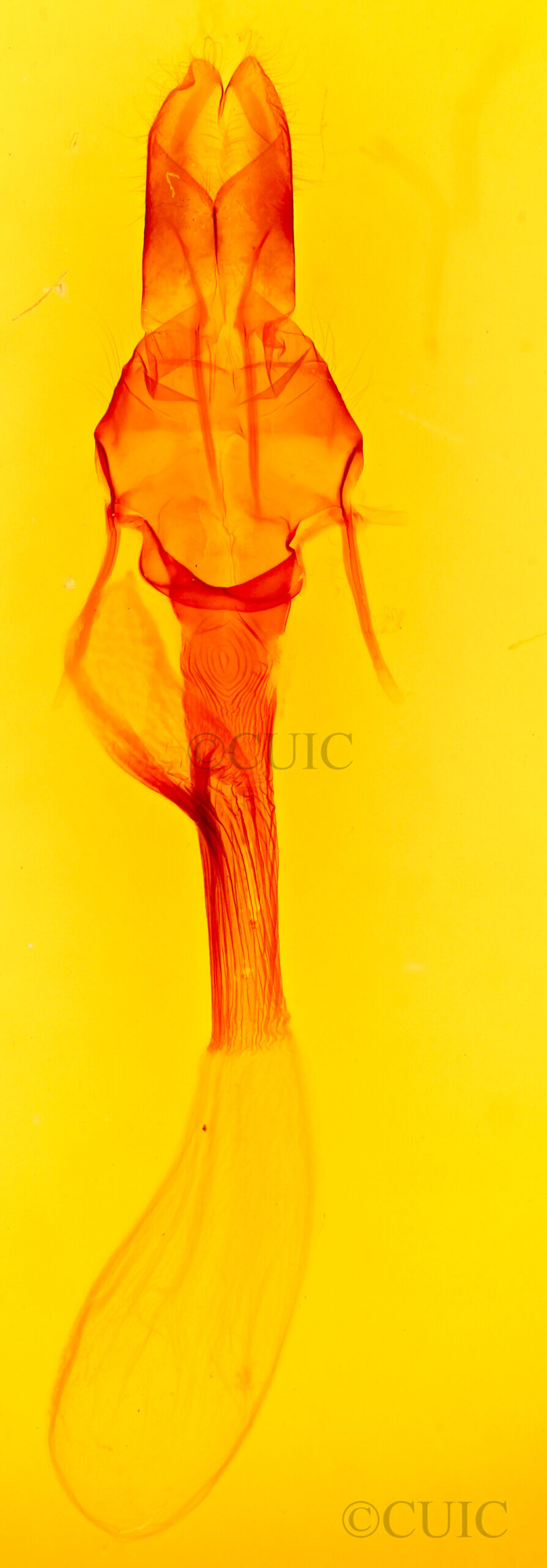genitalia view of adult Leucania inermis