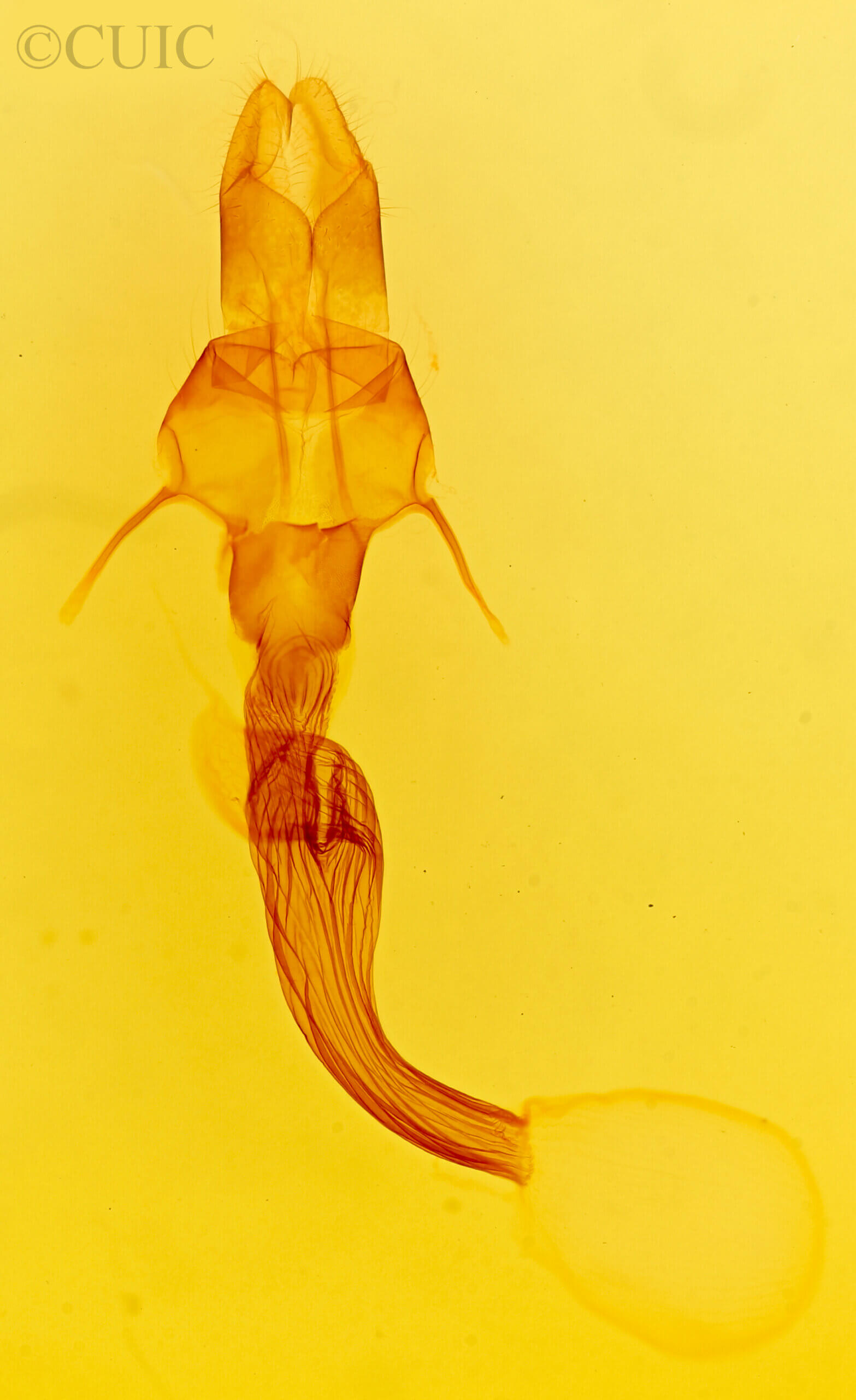 genitalia view of adult Leucania ursula