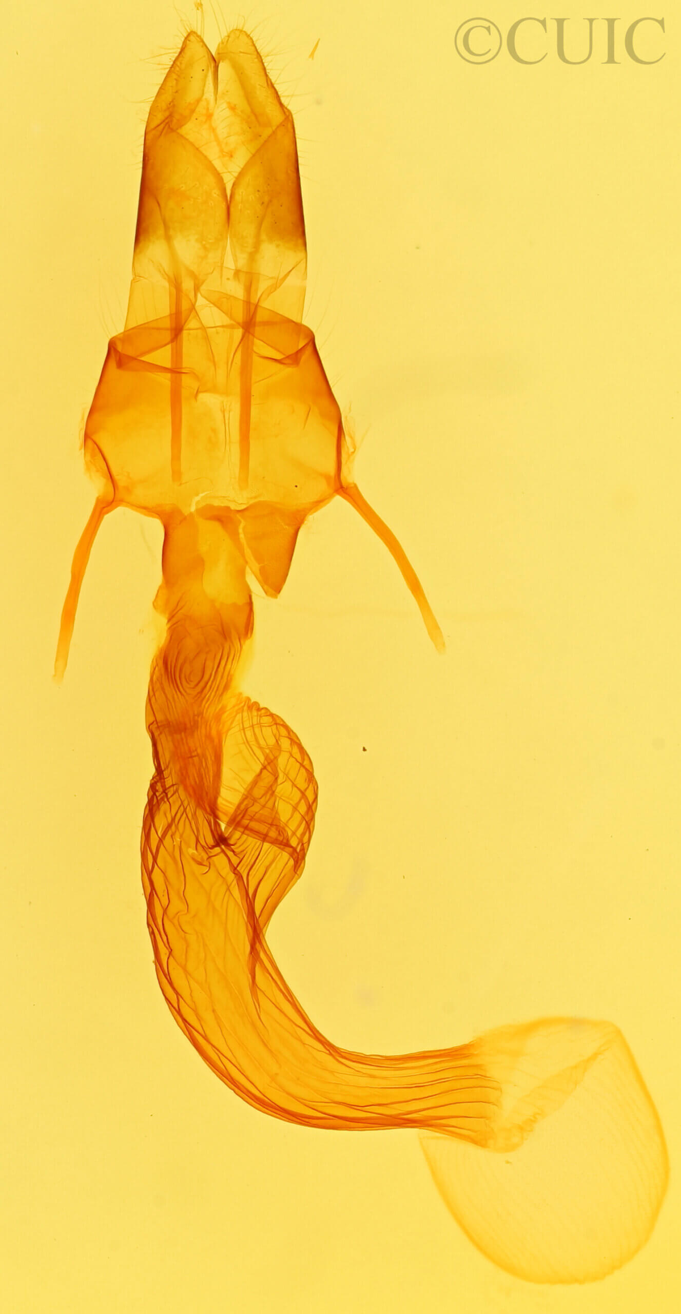 genitalia view of adult Leucania ursula