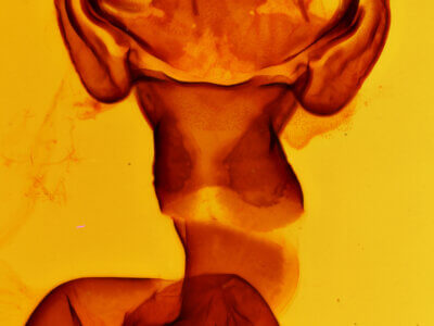 genitalia view of adult Estigmene acrea