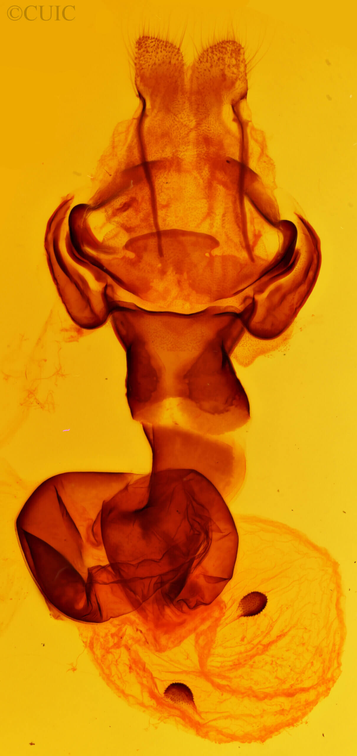genitalia view of adult Estigmene acrea