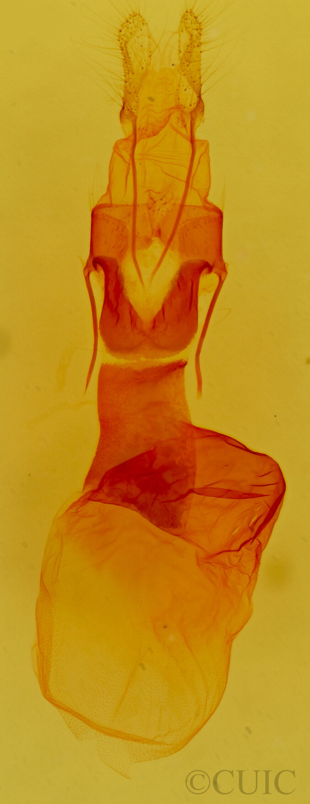 genitalia view of adult Caradrina camina