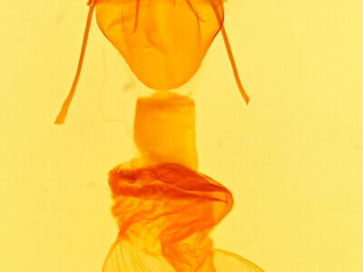 genitalia view of adult Caradrina multifera