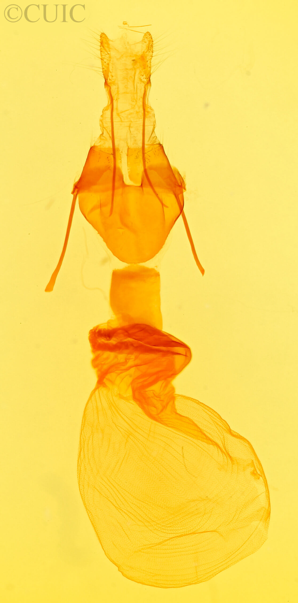 genitalia view of adult Caradrina multifera