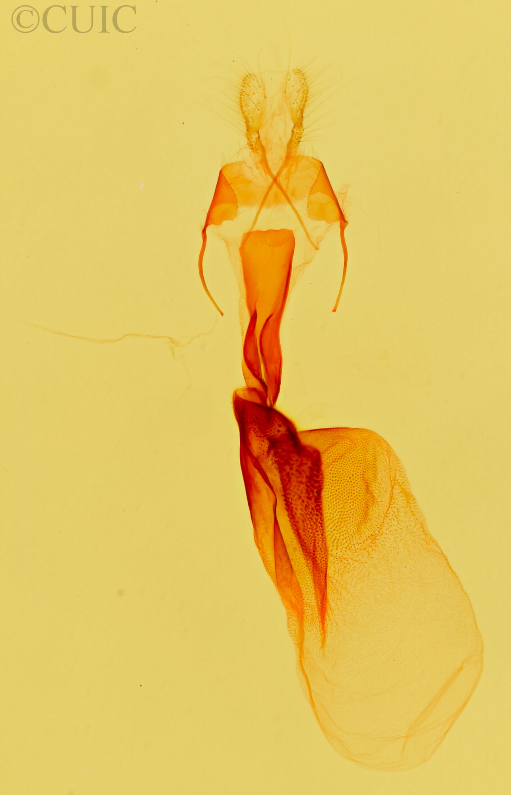 genitalia view of adult Acontia albifusa